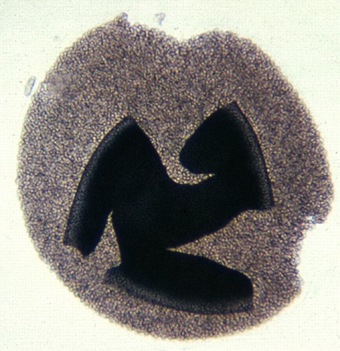 a4 pilobolus spore mass crushed by coverslip